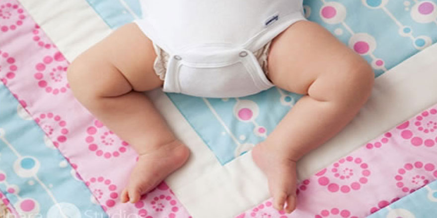 Bebeklerde Kalça Çıkıklığının 4 Nedeni