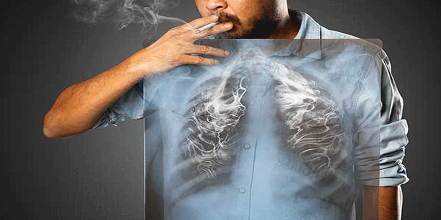 Sigara bırakıldığında akciğerler kendini iyileştiriyor