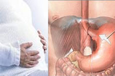Gebelik hormonları reflüye yol açabiliyor