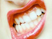 Toplumun %70’i Dişlerini Sıkıyor
